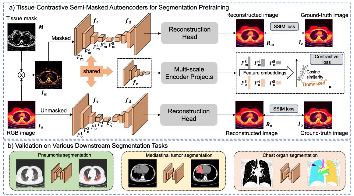 TCS-MAE Image